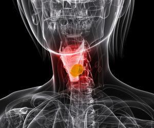 Лечение пареза голосовой связки