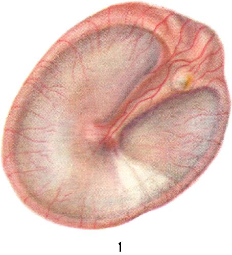 -лопнула перепонка в ухе что делать