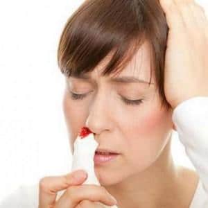 - техника выполнения остановки носового кровотечения у детей