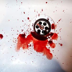 Причины появления крови в слюне без кашля