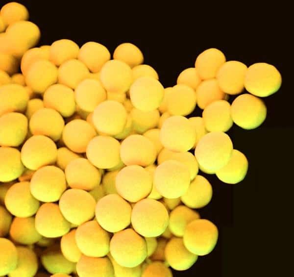 stafilokokk-v-ukhe-lecheniye-2