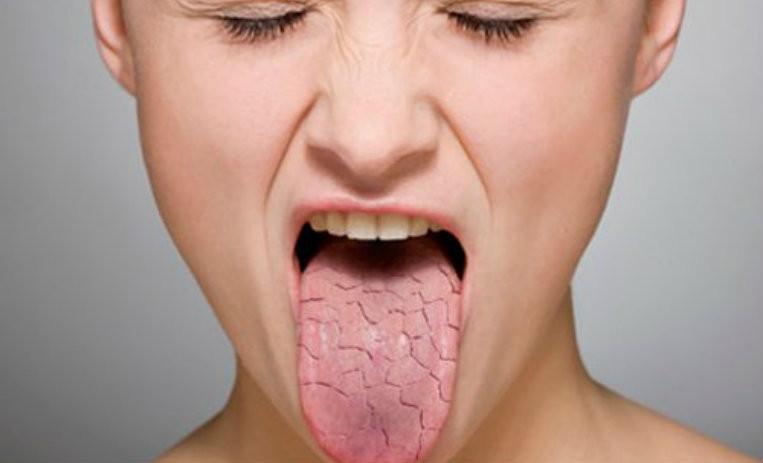 сухость во рту причины какой болезни ночью