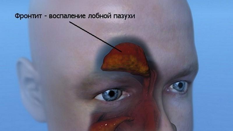 болезни связанные с носом
