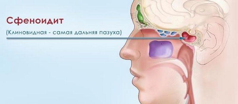 болезни слизистой носа