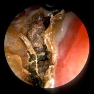 болезни связанные с носом