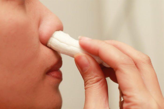 сгустки крови из носа у ребенка