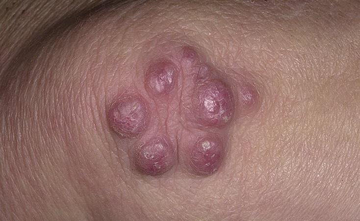 опухло возле уха ближе к щеке