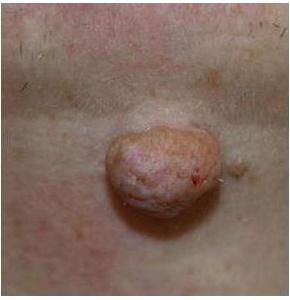 опухла щека возле уха