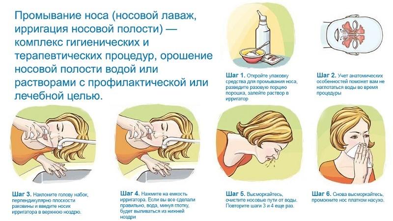 при высмаркивании закладывает уши