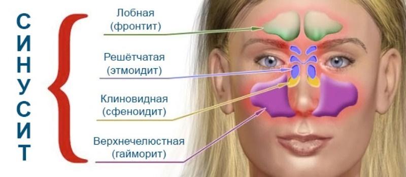 почему болит голова от насморка