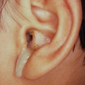 закладывает уши и давит на голову