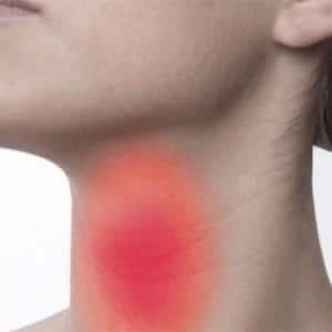 Что такое абсцесс горла