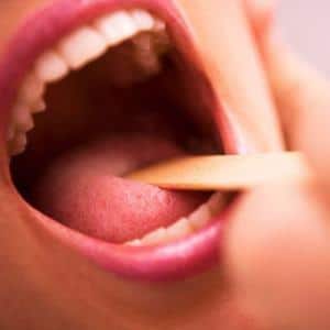 Что такое миндалины в горле