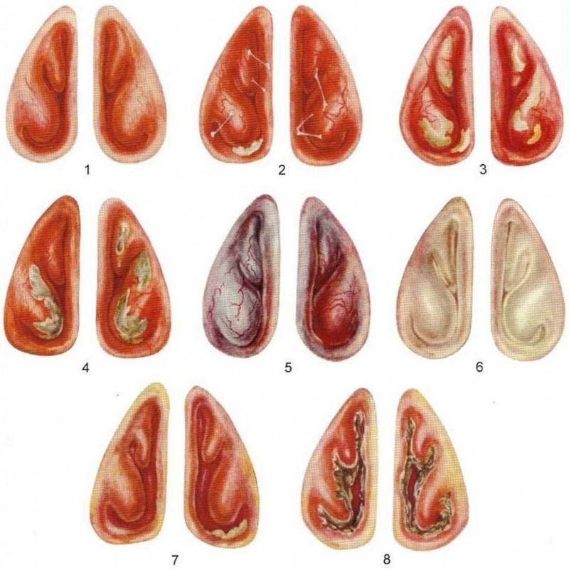 Как распознать и вылечить ринит?