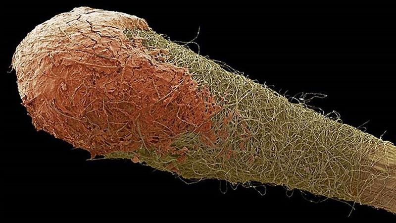 что такое ушная сера