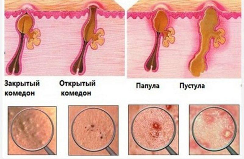 что то вскочило в ухе и болит