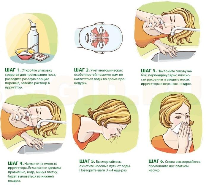 признаки гайморита и фронтита