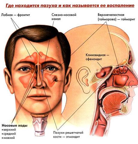 gajmorova-pazuha-kista