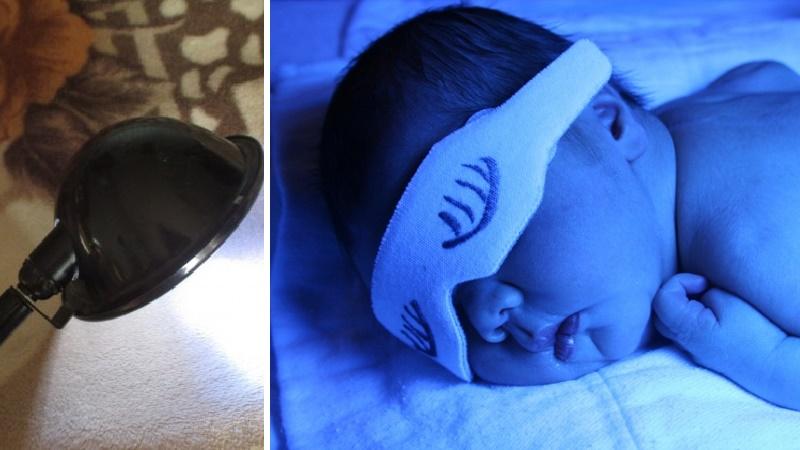 прогревание при насморке синей лампой