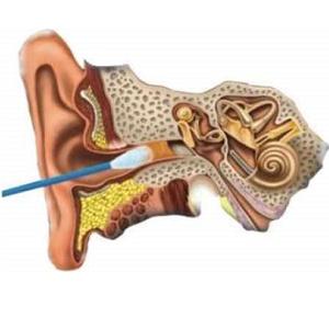серная пробка