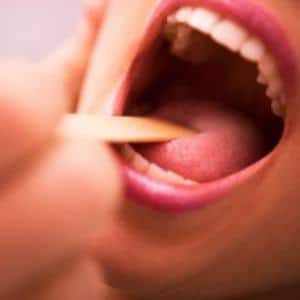 Как избавиться от тонзиллита навсегда