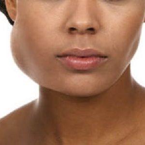 сиалоаденит околоушной слюнной железы