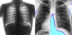 профилактика