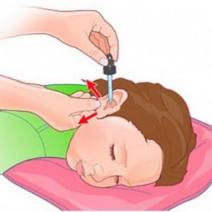 лечение отита перекисью водорода