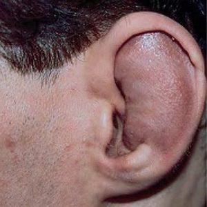 слуховой канал