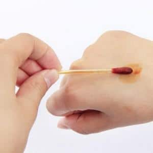 как правильно наносить йодную сетку на грудную клетку