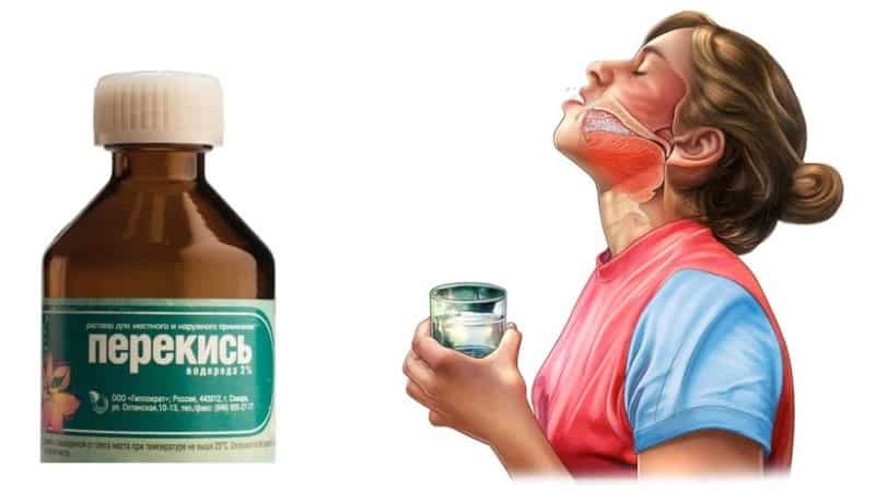 Как в домашних условиях вылечить ангину