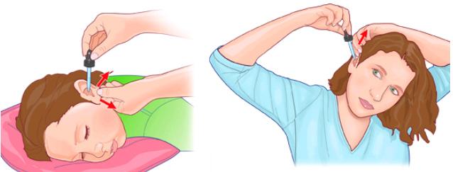 сульфацил натрия в ухо-1