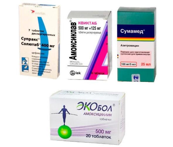 антибиотики при рините