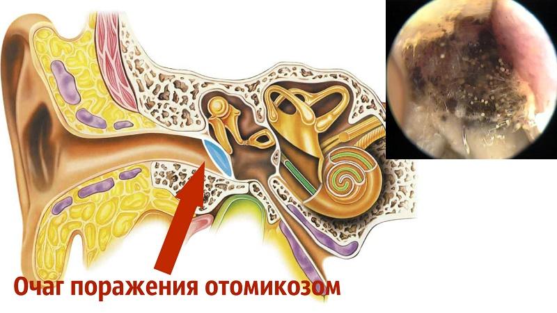 болезни уха у взрослых симптомы и лечение