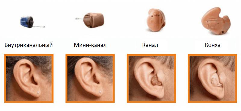 самый маленький слуховой аппарат