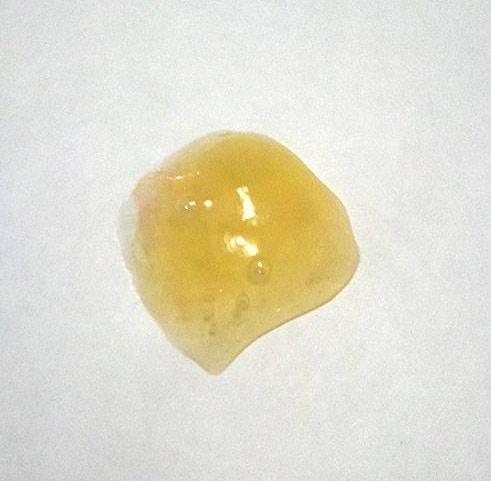 жёлтые сопли при гайморите фото