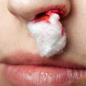 капли в нос при аденоидах у детей