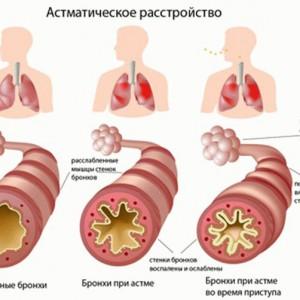кашель после тренировки