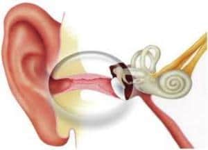 Лечение катарального отита