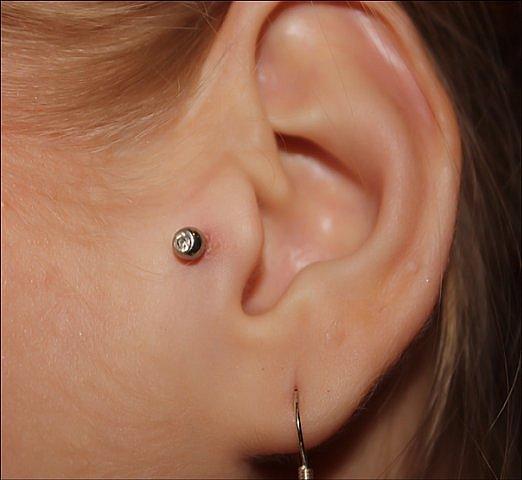 Козелок уха фото