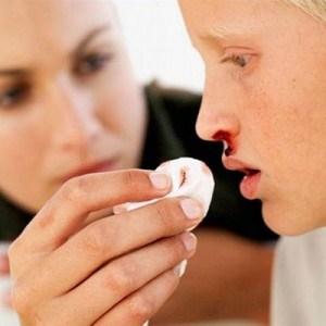 лечение носового кровотечения у детей