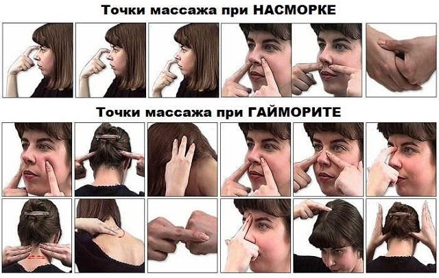 что делать если у ребенка гайморит