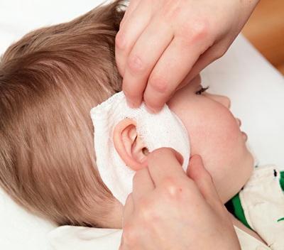 Лечение экссудативного отита у детей