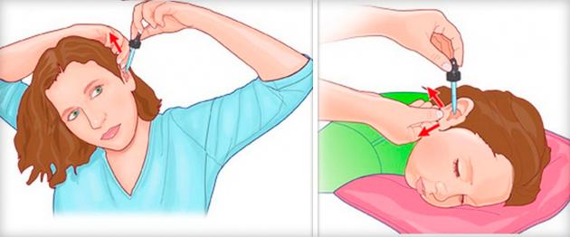 mozhno-li-kapat'-naftizin-v-ukho-2