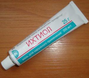ихтиоловая мазь при отите