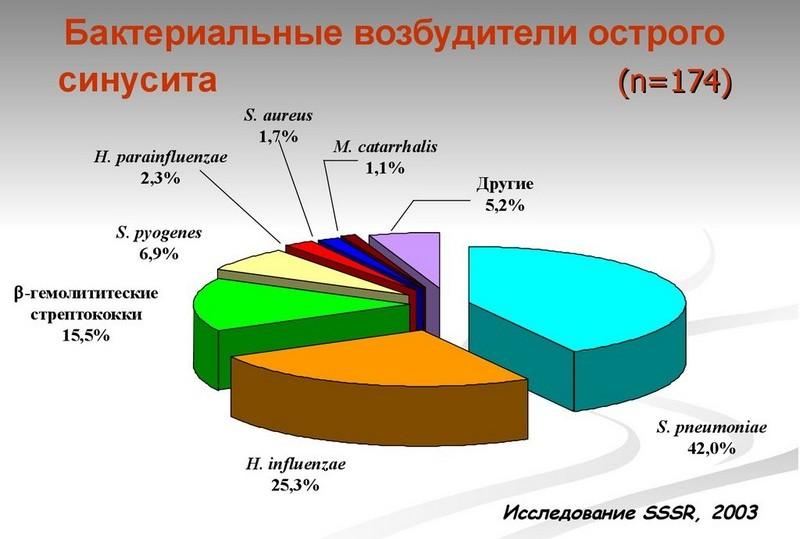 лечение одонтогенный синусит