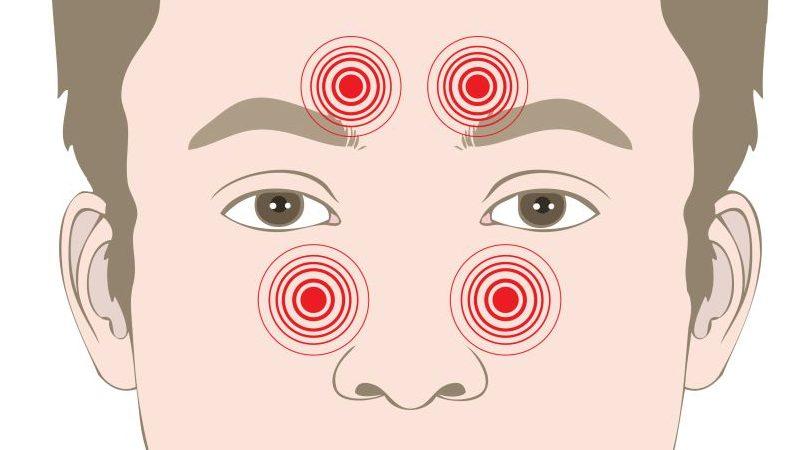 левосторонний фронтит