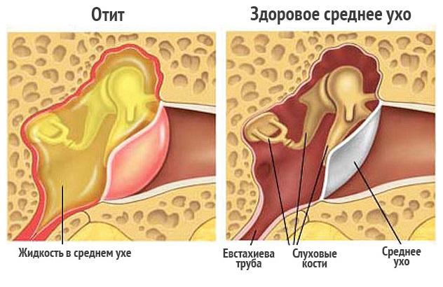 почему в ухе мокро-3