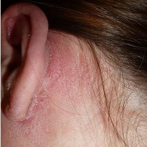 чешется за ухом