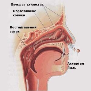 от чего бывает насморк